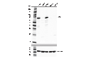ITK (E4X7M) Rabbit mAb