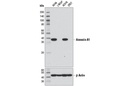 Annexin A1 (D5V2T) XP Rabbit mAb