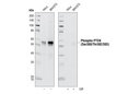 Phospho-PTEN (Ser380/Thr382/383) (44A7) Rabbit mAb