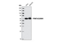 PRMT4/CARM1 (C31G9) Rabbit mAb