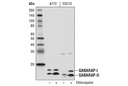 GABARAP (E1J4E) Rabbit mAb
