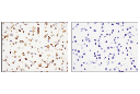 CXCR5 (D6L3C) Rabbit mAb (IHC Specific)