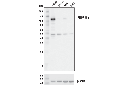 PKD/PKCμ (D4J1N) Rabbit mAb