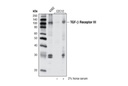 TGF-beta Receptor III (D11G10) Rabbit mAb