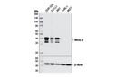 NKX2.5 (E1Y8H) Rabbit mAb