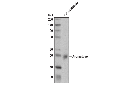 Aromatase (D5Q2Y) Rabbit mAb