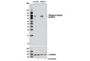 Phospho-β-Catenin (Ser552) (D8E11) Rabbit mAb