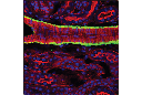 α-Smooth Muscle Actin (1A4) Mouse mAb (Alexa Fluor 488 Conjugate)