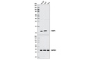 FABP1 (D2A3X) XP Rabbit mAb