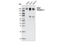 PDGF Receptor β (C82A3) Rabbit mAb