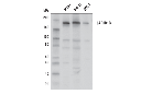JARID1B (E2X6N) Rabbit mAb