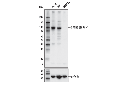 SATB2 (E8R8H) Rabbit mAb