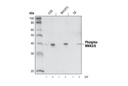 Phospho-MKK3 (Ser189)/MKK6 (Ser207) (22A8) Rabbit mAb