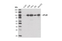 cPLA2 (D49A7) Rabbit mAb