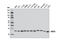 UBE2S (D5H9H) Rabbit mAb