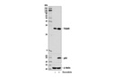 TIGAR (D3F4A) Rabbit mAb