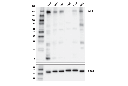SLIT2 (E8W7Y) Rabbit mAb