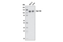 Bcl-11B (D6F1) XP Rabbit mAb