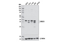 ERCC1 (D6G6) XP Rabbit mAb