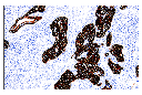 Keratin 5 (E2T4B) XP Rabbit mAb (IHC Preferred)