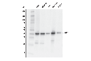 GOT1 (E4A4O) Rabbit mAb