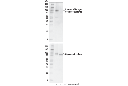 Phospho-Glycogen Synthase (Ser641) (D4H1B) XP Rabbit mAb