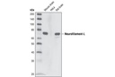 Neurofilament-L (C28E10) Rabbit mAb