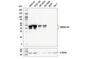 MAGE-A4 (E7O1U) XP Rabbit mAb