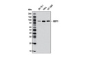 CD71 (D7S5Z) Rabbit mAb