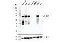 SLP-76 (E4N7E) Rabbit mAb