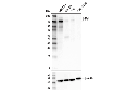 Met (E4E4W) Rabbit mAb (Mouse Preferred)