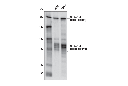 WHSC1L1 (D4N9N) Rabbit mAb