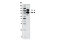 Progesterone Receptor A/B (C89F7) Rabbit mAb