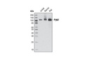 Pyk2 (5E2) Mouse mAb