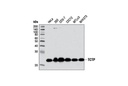 TCTP (D10F2) Rabbit mAb