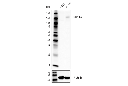 CD11α (E5S9K) Rabbit mAb