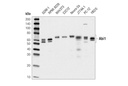 Abi1 (D3G6C) Rabbit mAb