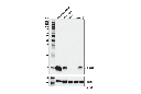 S100A8 (E4F8V) XP Rabbit mAb