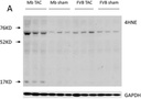 Anti-4 Hydroxynonenal antibody