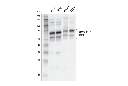 ZMYND11/BS69 (E7P9O) Rabbit mAb