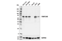 FAM134B (E8Y9R) Rabbit mAb