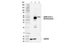 SARS-CoV-2 Nucleocapsid Protein (E8R1L) Mouse mAb